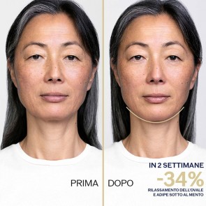 Vital Perfection Liftdefine Night Concentrate